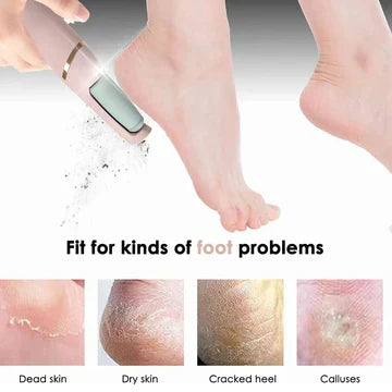 RECHARGABLE FOOT CALLUS REMOVER